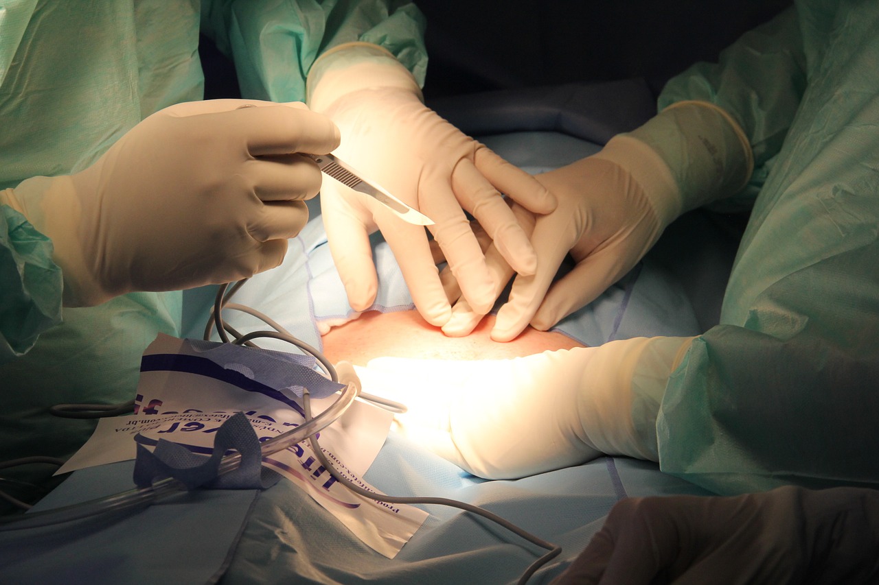 Open surgical biopsy